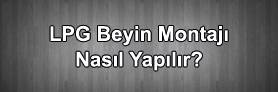 Lpg Beyin Montajı Nasıl Yapılır ?